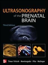 Ultrasonography of the prenatal & neonatal brain