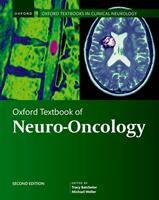   Oxford Textbook of Neuro-Oncology