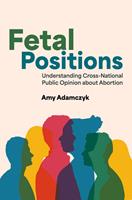   Fetal Positions