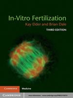   In-Vitro Fertilization