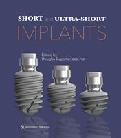   Short and Ultra-Short Implants