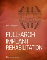   Full-Arch Implant Rehabilitation
