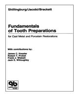   Fundamentals of Tooth Preparations for Cast Metal and Porcelain Restorations