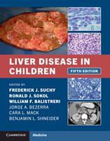   Liver Disease in Children