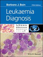   Leukaemia Diagnosis