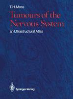   Tumours of the Nervous System