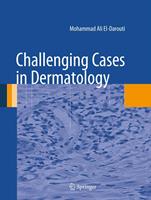   Challenging Cases in Dermatology