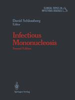   Infectious Mononucleosis