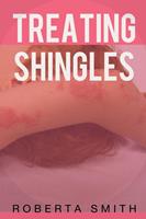   Treating Shingles