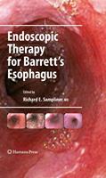   Endoscopic Therapy for Barrett's Esophagus