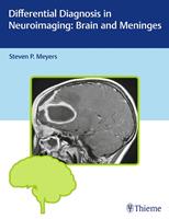   Differential Diagnosis in Neuroimaging: Brain and Meninges