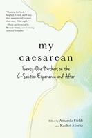   My Caesarean: Twenty-One Mothers on the C-Section Experience and After