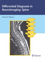   Differential Diagnosis in Neuroimaging: Spine