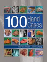   100 Hand Cases