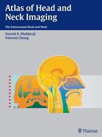   Atlas of Head and Neck Imaging