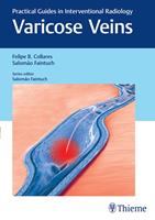  Varicose Veins