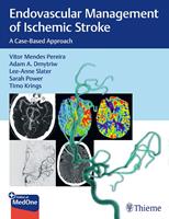   Endovascular Management of Ischemic Stroke