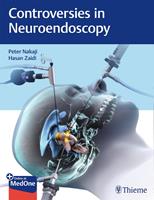   Controversies in Neuroendoscopy