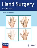   Hand Surgery