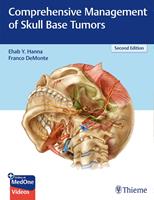   Comprehensive Management of Skull Base Tumors