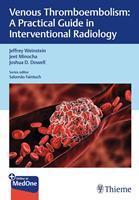   Venous Thromboembolism