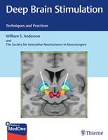   Deep Brain Stimulation