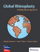   Global Rhinoplasty