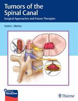   Tumors of the Spinal Canal
