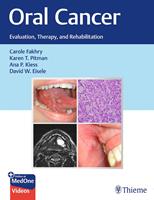   Oral Cancer