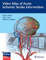   Video Atlas of Acute Ischemic Stroke Intervention