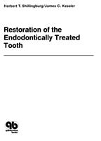  Restoration of the Endodontically Treated Tooth