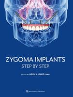   Zygoma Implants