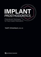   Implant Prosthodontics