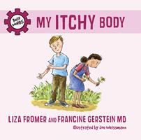   My Itchy Body