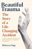   Beautiful Trauma