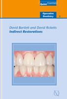   Indirect Restorations