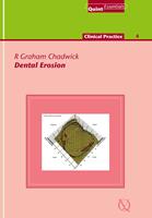   Dental Erosion