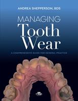   Managing Tooth Wear