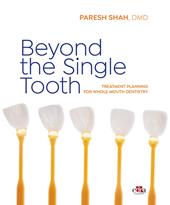 Beyond the Single Tooth. Treatment planning for whole mouth dentistry