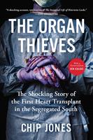   The Organ Thieves