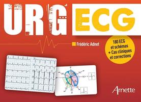   URG'ECG