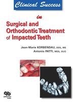 Clinical Success in Surgical and Orthodontic Treatment of Impacted Teeth