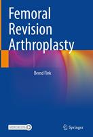   Femoral Revision Arthroplasty
