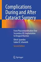   Complications During and After Cataract Surgery