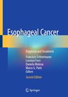   Esophageal Cancer