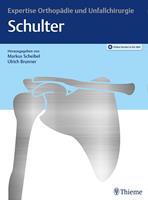   Expertise Schulter