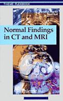 Normal Findings in CT and MRI