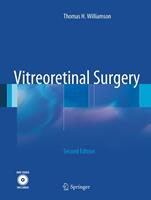   Vitreoretinal Surgery