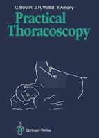   Practical Thoracoscopy