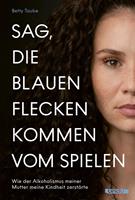 Sag, die blauen Flecken kommen vom Spielen